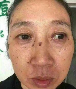 去老年斑的簡(jiǎn)單方法，重拾肌膚光彩的秘訣，去老年斑秘籍，重拾肌膚光彩的簡(jiǎn)易方法