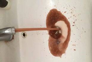 拉稀水是什么原因——深度解析腸道健康與疾病成因，拉稀水的原因深度解析，腸道健康與疾病成因探究