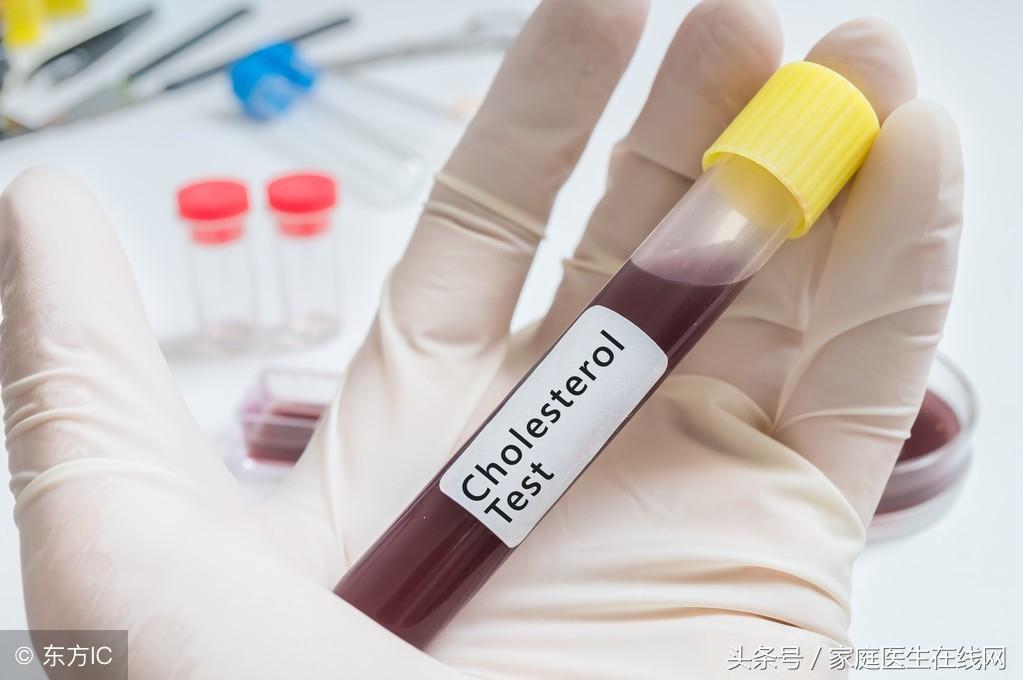 糖尿病的成因，深度解析其背后的原因，深度解析糖尿病成因，揭示背后原因真相