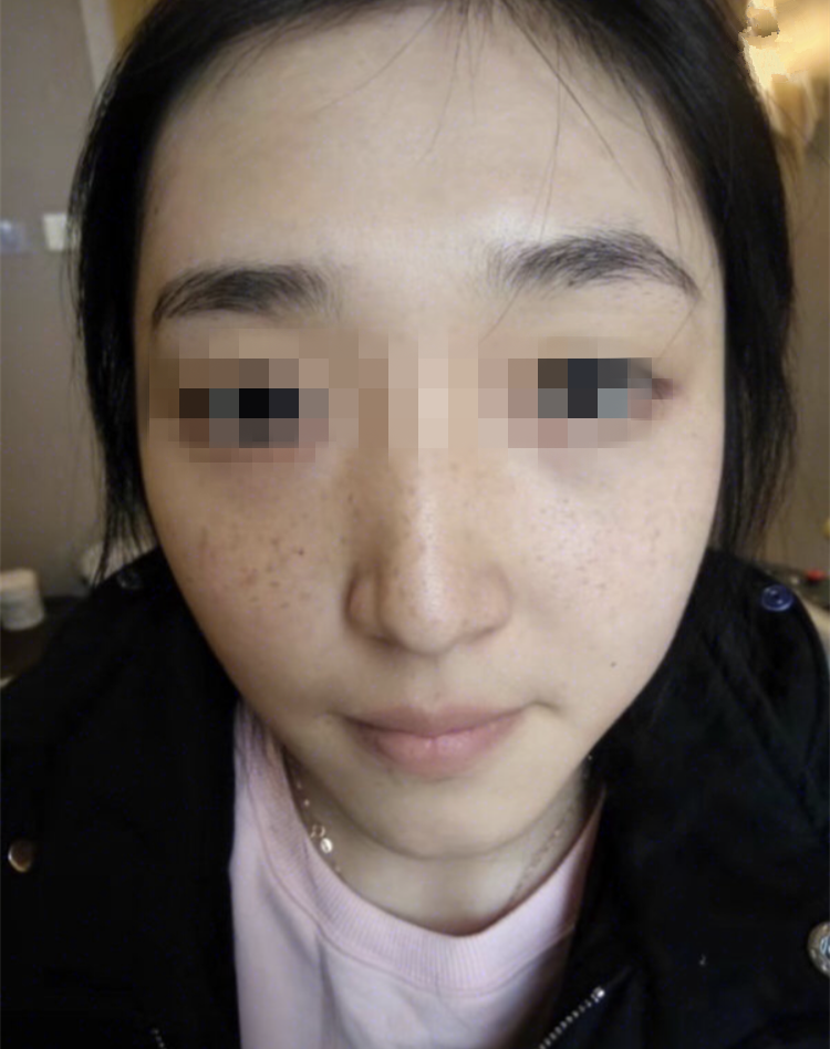 正規(guī)醫(yī)院祛斑效果深度解析，安全與效果的雙重保障，正規(guī)醫(yī)院祛斑效果深度解析，雙重保障下的安全與效果體驗(yàn)