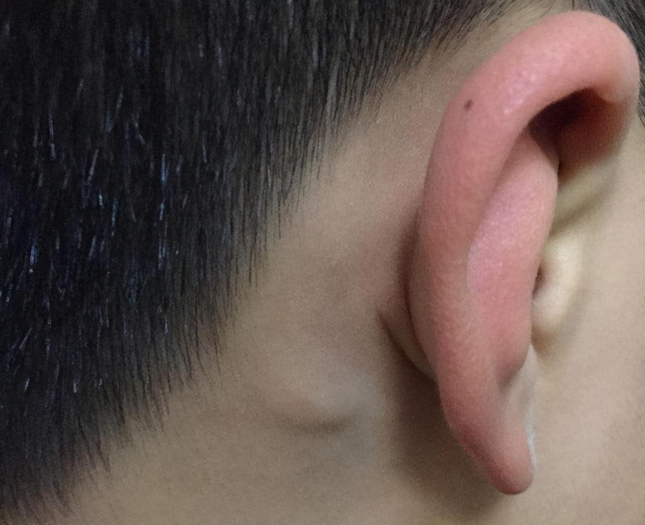 耳朵里面疼是怎么回事，深度解析與應(yīng)對(duì)建議，耳朵內(nèi)部疼痛原因深度解析及應(yīng)對(duì)建議