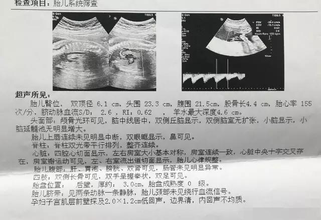 殲-11B重型戰(zhàn)斗機(jī)，卓越性能與先進(jìn)技術(shù)的完美結(jié)合，殲-11B重型戰(zhàn)斗機(jī)，卓越性能與技術(shù)的巔峰融合