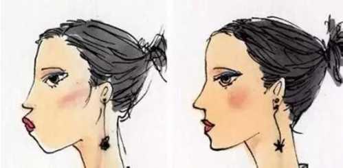 鼻子整形后能否永久保持？全面解析鼻子整形手術(shù)的持久性，鼻子整形手術(shù)的持久性與永久保持的可能性解析